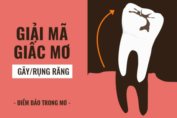 Điềm báo khi nằm mơ bị rụng răng và con số may mắn tương ứng